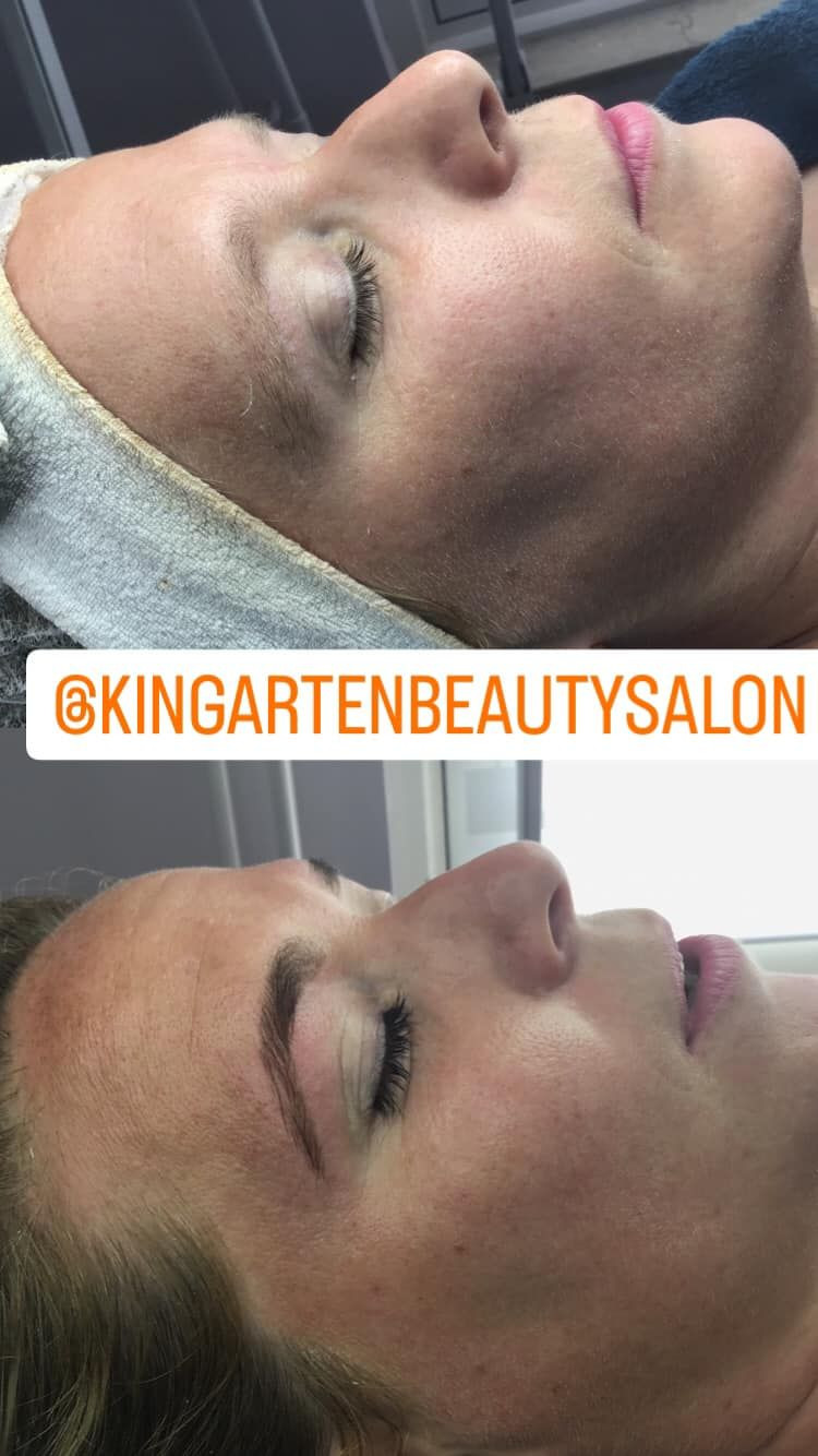 photo - Kinga Beautysalon