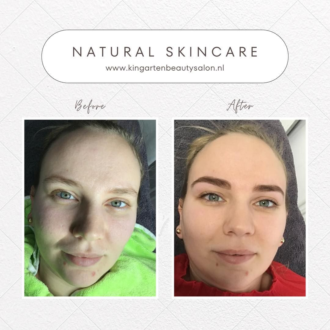 photo - Kinga Beautysalon