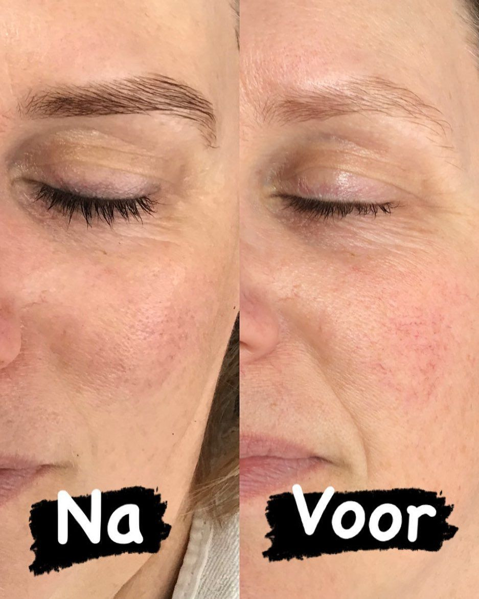 photo - Kinga Beautysalon