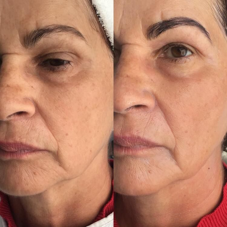 photo - Kinga Beautysalon